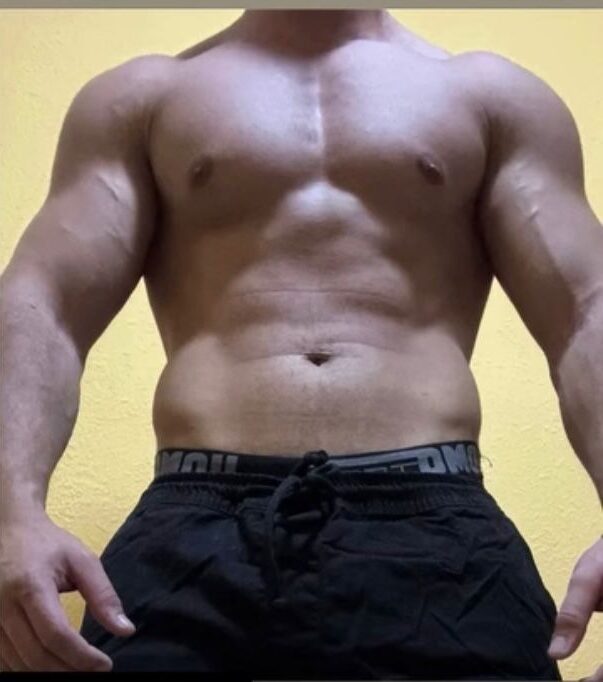 Espacio reservado para foto de transformación de cliente